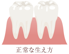 正常のな生え方