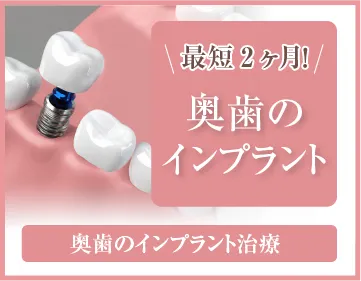 奥歯のインプラント