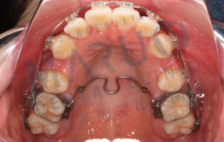 orthodontics_case_06.png