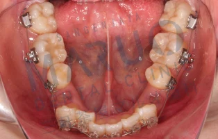 orthodontics_case_07.png
