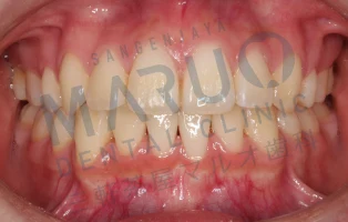 orthodontics_case_09.png