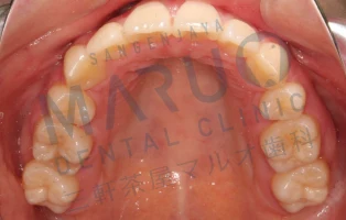 orthodontics_case_10.png