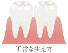 正常のな生え方