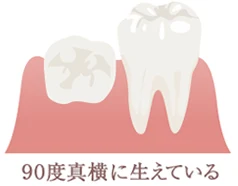 90度真横に生えている