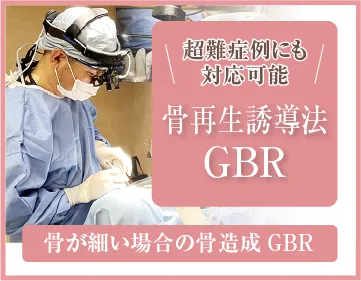 骨再生誘導法 GBR